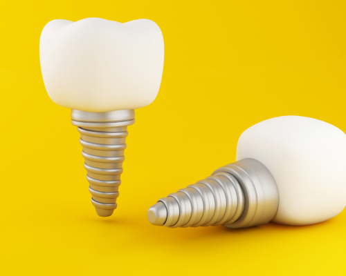 instituto buquera ribeiro gold align implante dentario instituto buquera ribeiro gold align implante dentario